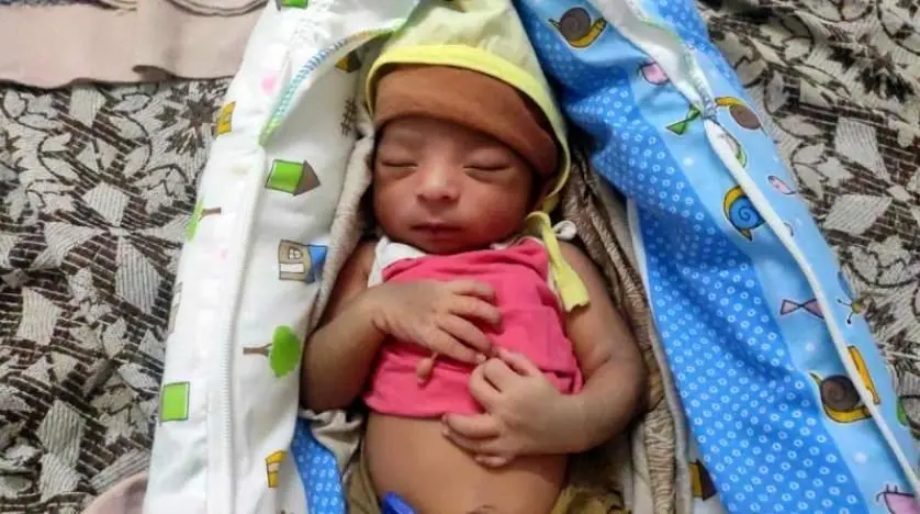 تولد نوزادی با ۲۴ انگشت در هند + عکس