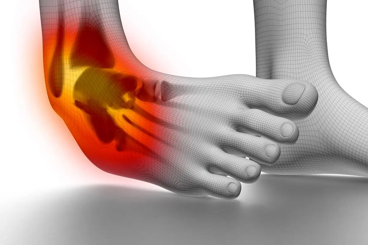 درد‌های مچ پا را جدی بگیرید؛ شاید خطرناک باشد