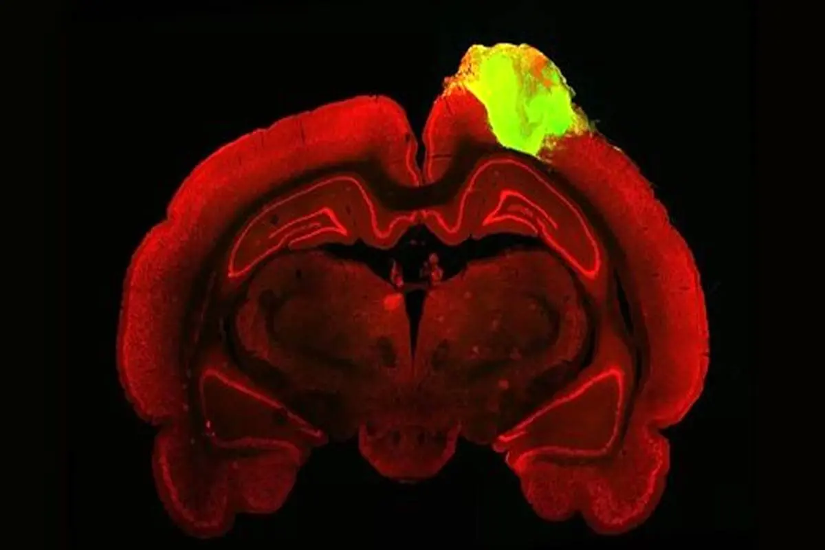 عکس| ثبت دقیق‌ترین تصویر سلول‌های مغز با یک میکروسکوپ مینیاتوری