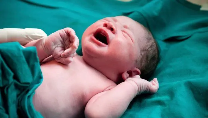 تولد نوزادان در ترکیه با دُم یا یک دست یا یک چشم، حقیقت یا شایعه؟