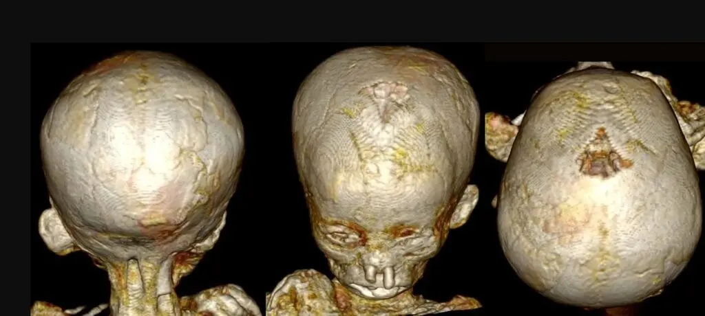 کشف راز مرگ کودکان در مصر باستان به کمک سی‌تی‌اسکن! + تصاویر