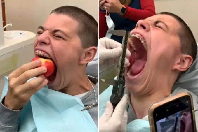 بزرگ‌ترین دهان انسان! +عکس