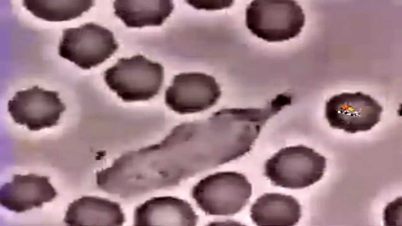 ویدئویی جالب از تعقیب و گریز یک گلبول سفید و باکتری!