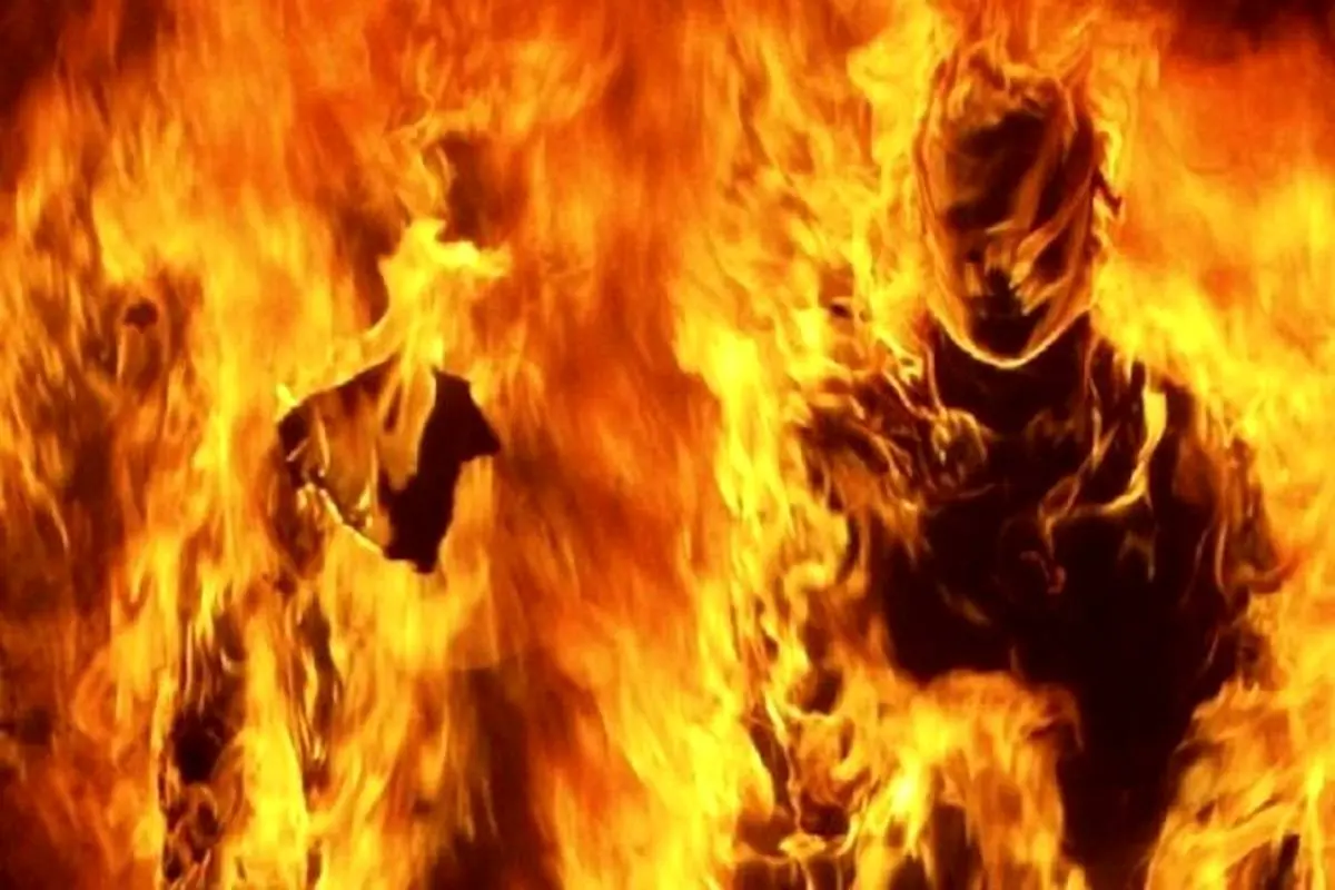 پسر عاشق‌پیشه تهرانی جلوی دختر همسایه خودش را آتش زد!