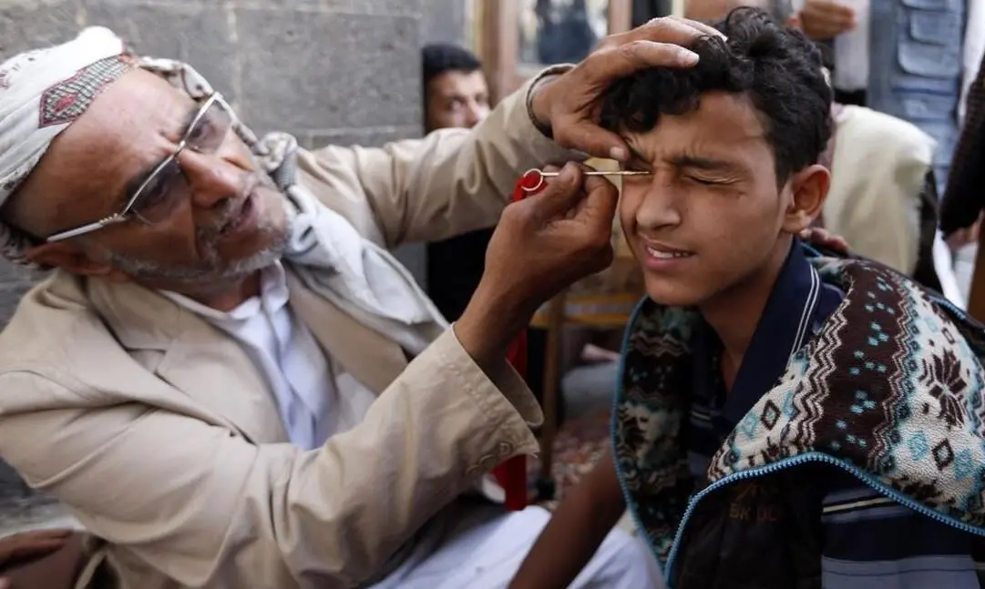 فیلم| سُرمه کشیدن مردان یمنی در ماه رمضان