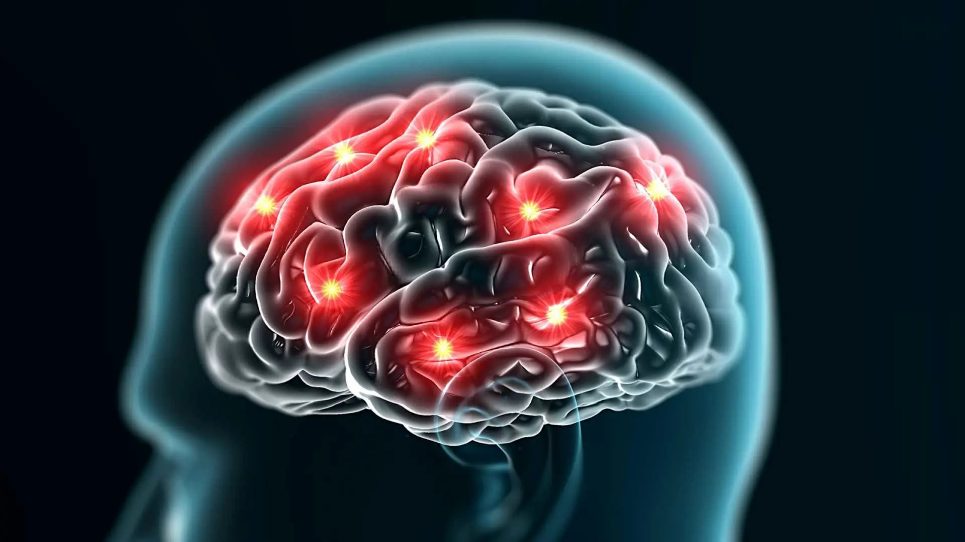 شناسایی فعالیت های رازآلود قبل از مرگ، در مغز بیماران مرگ مغزی