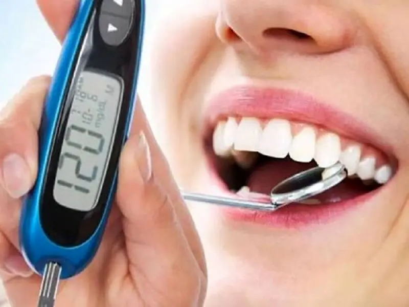 دیابت با معاینه دندان هم قابل تشخیص است